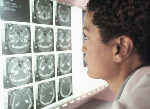 Doctor reviewing CT scan.