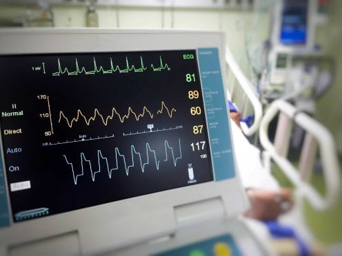 An EKG machine.