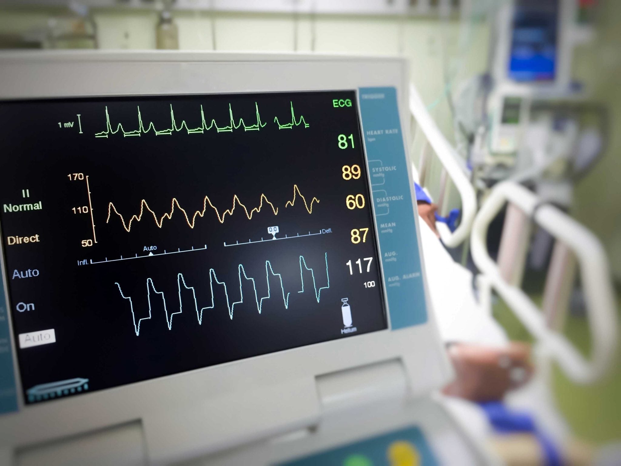 What Causes An Irregular Heartbeat?