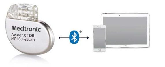 Medtronic Pacemaker MRI