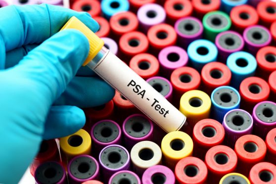 PSA test
