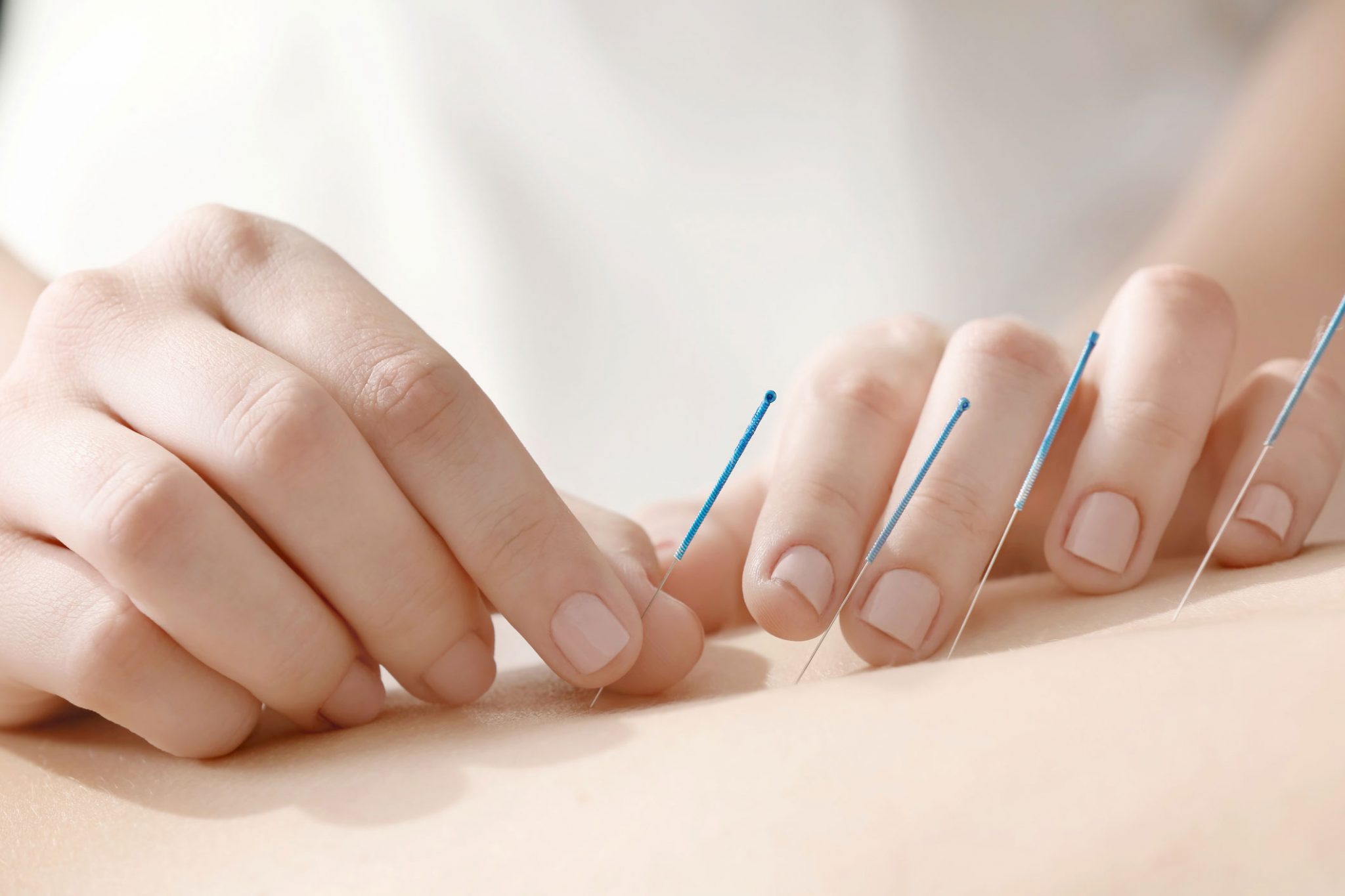 Acupuncture and Cancer