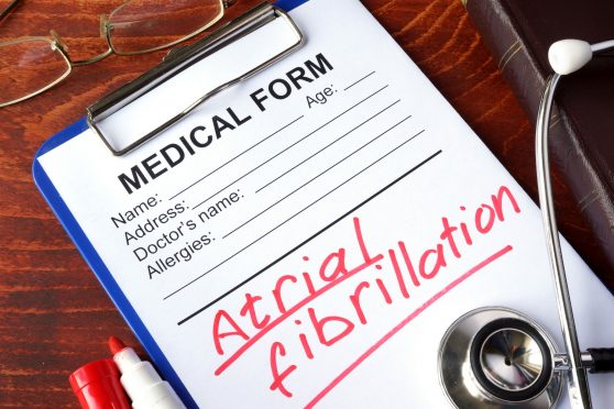 Apple Watch and AFib