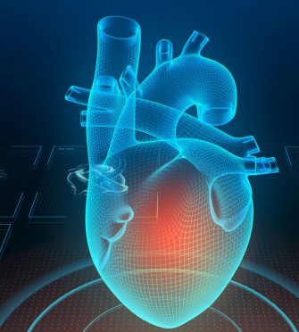 Coronary calcium score.