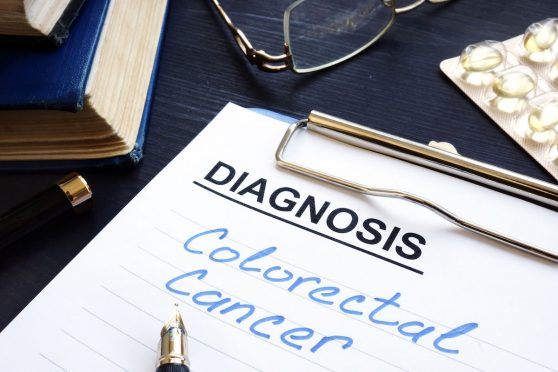 Colorectal Cancer