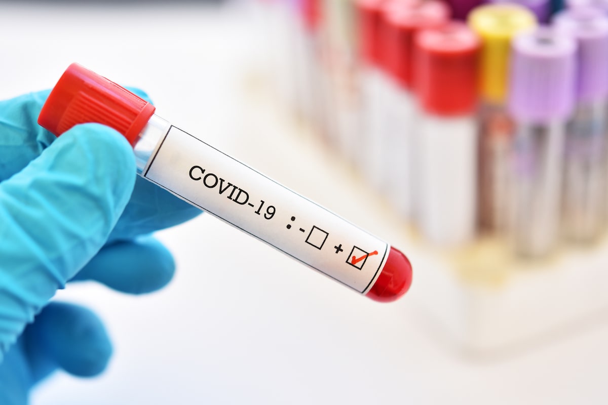 CDC Identifies More Symptoms of COVID-19 Infection