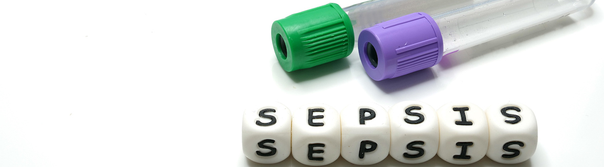 Sepsis: When an Infection Can Become a Silent Killer