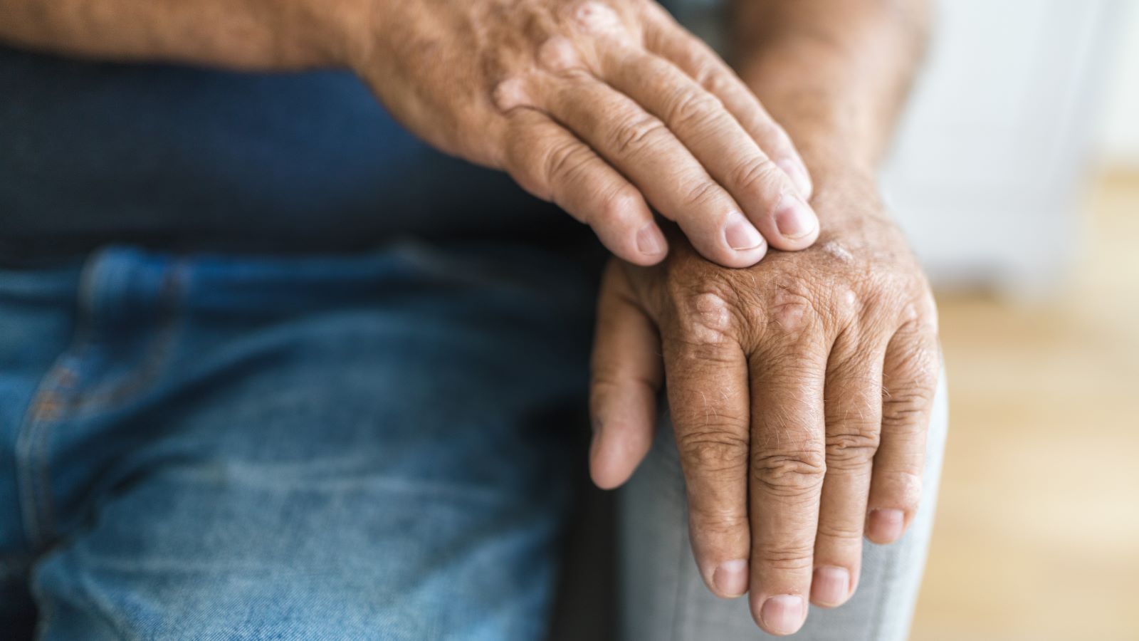 5 Natural Ways to Treat Psoriatic Arthritis