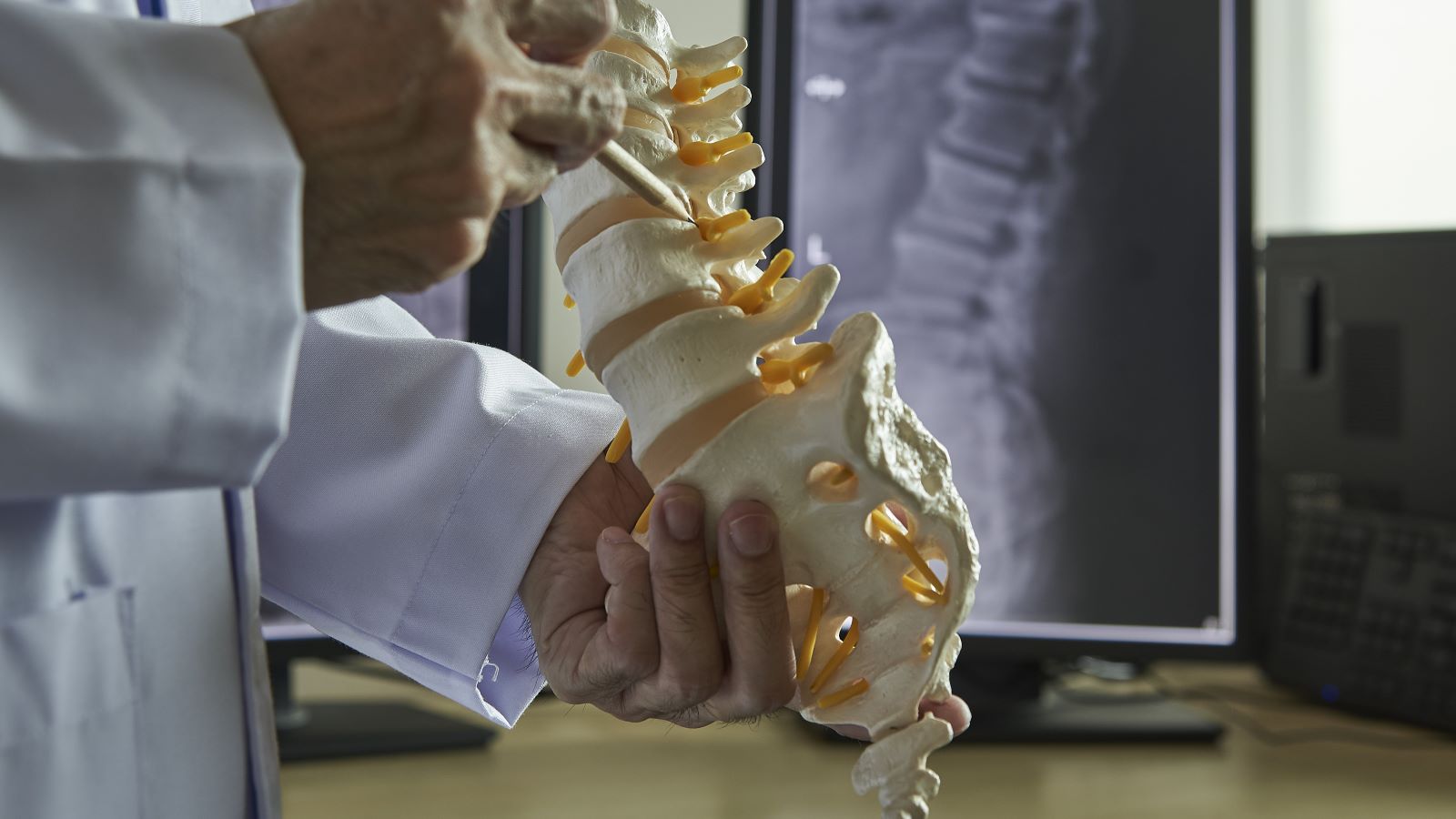 Thinking About Spine Surgery? Here Are 5 Things to Know