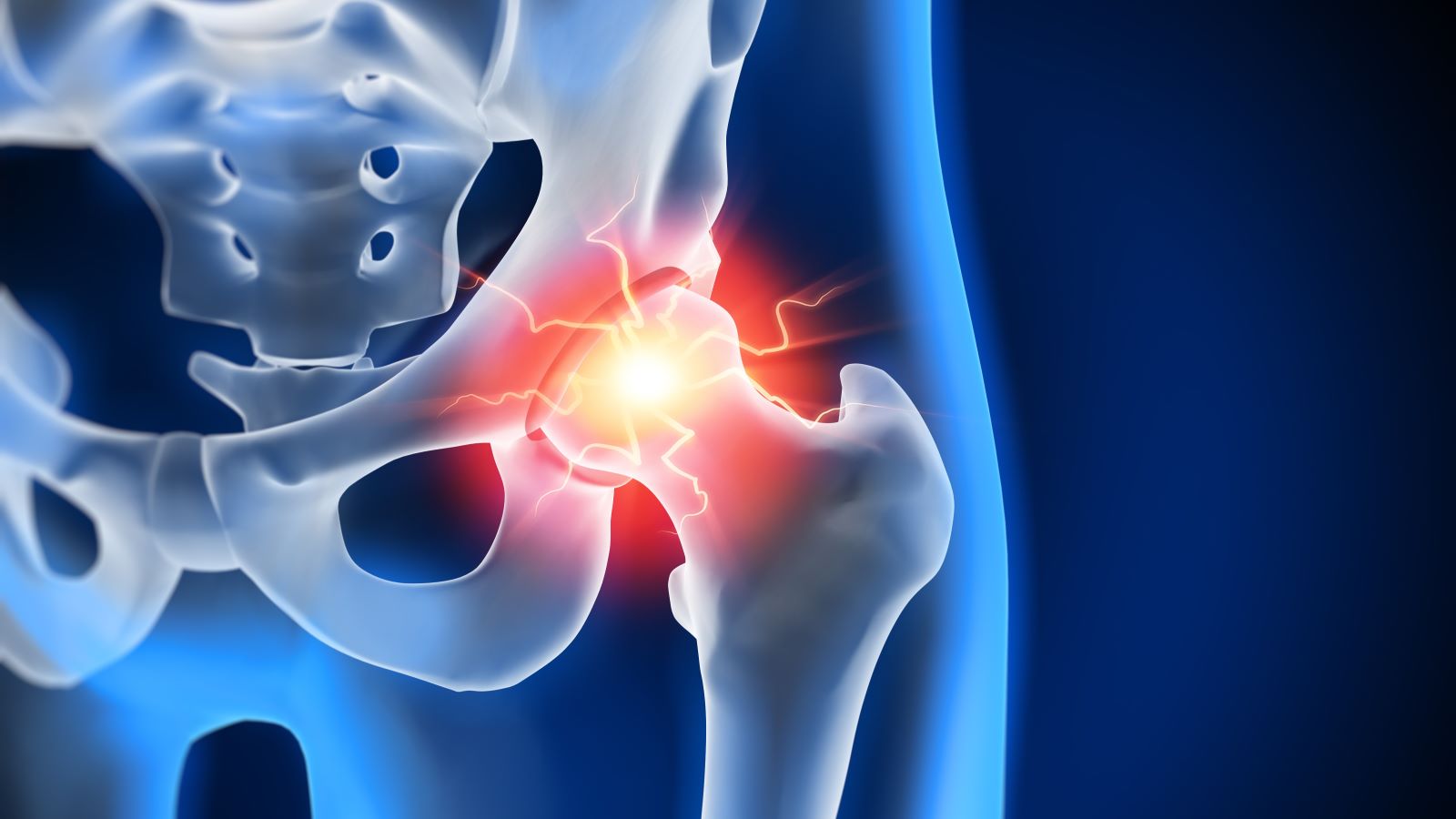 5 Things That Might Be Making Your Hip Pain Worse