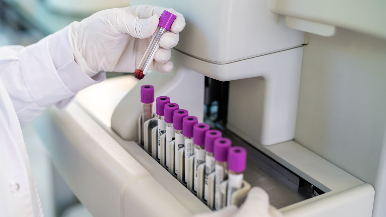 5 Tips for Understanding Your Bloodwork Results