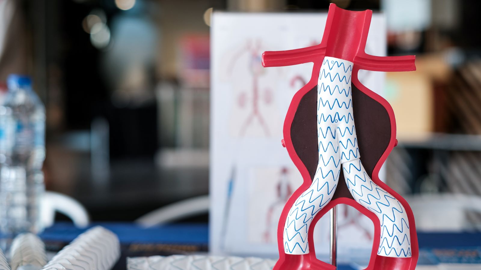 Do Aortic Aneurysms Always Burst?