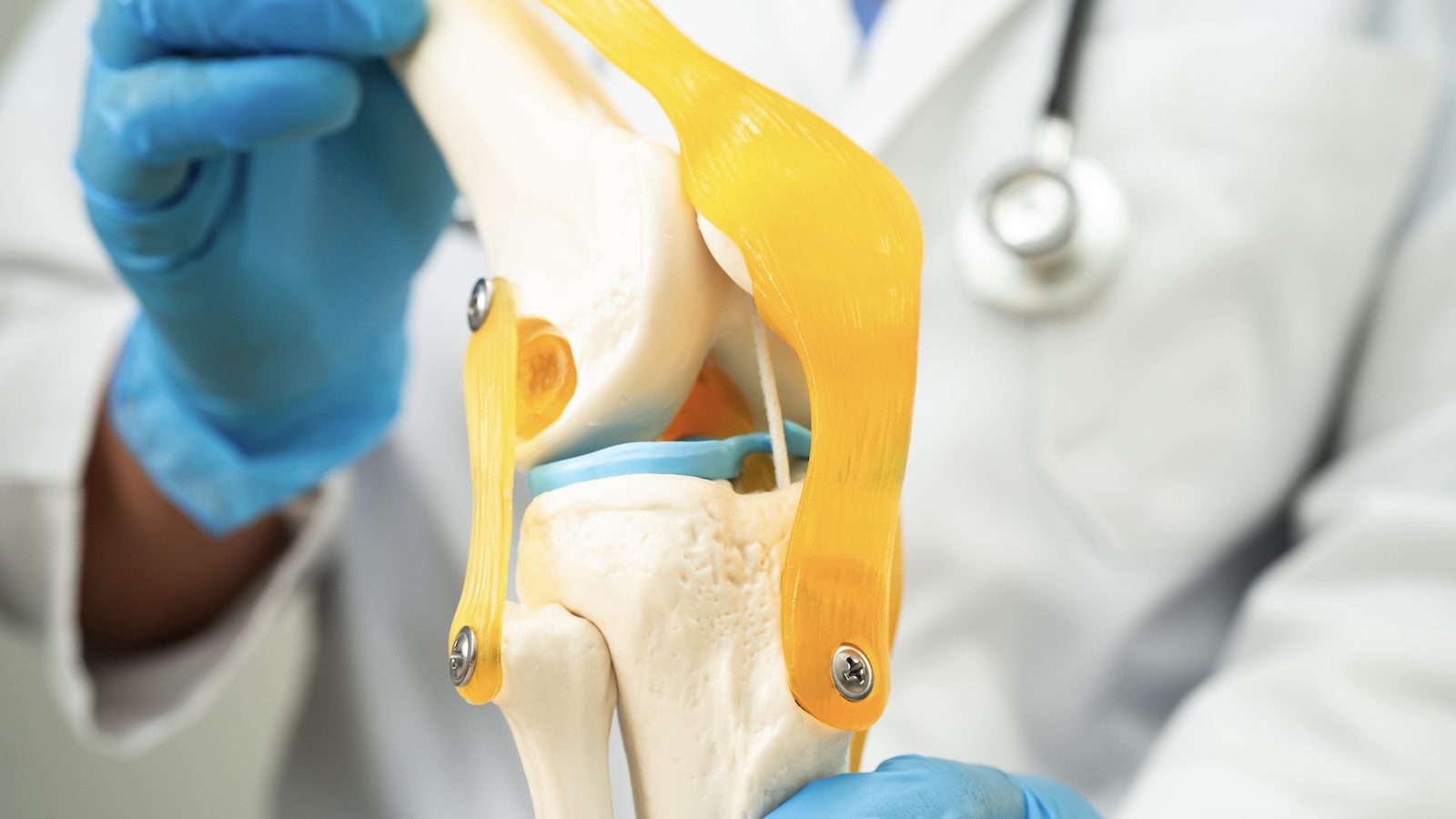 How Long Do Knee Replacements Really Last?