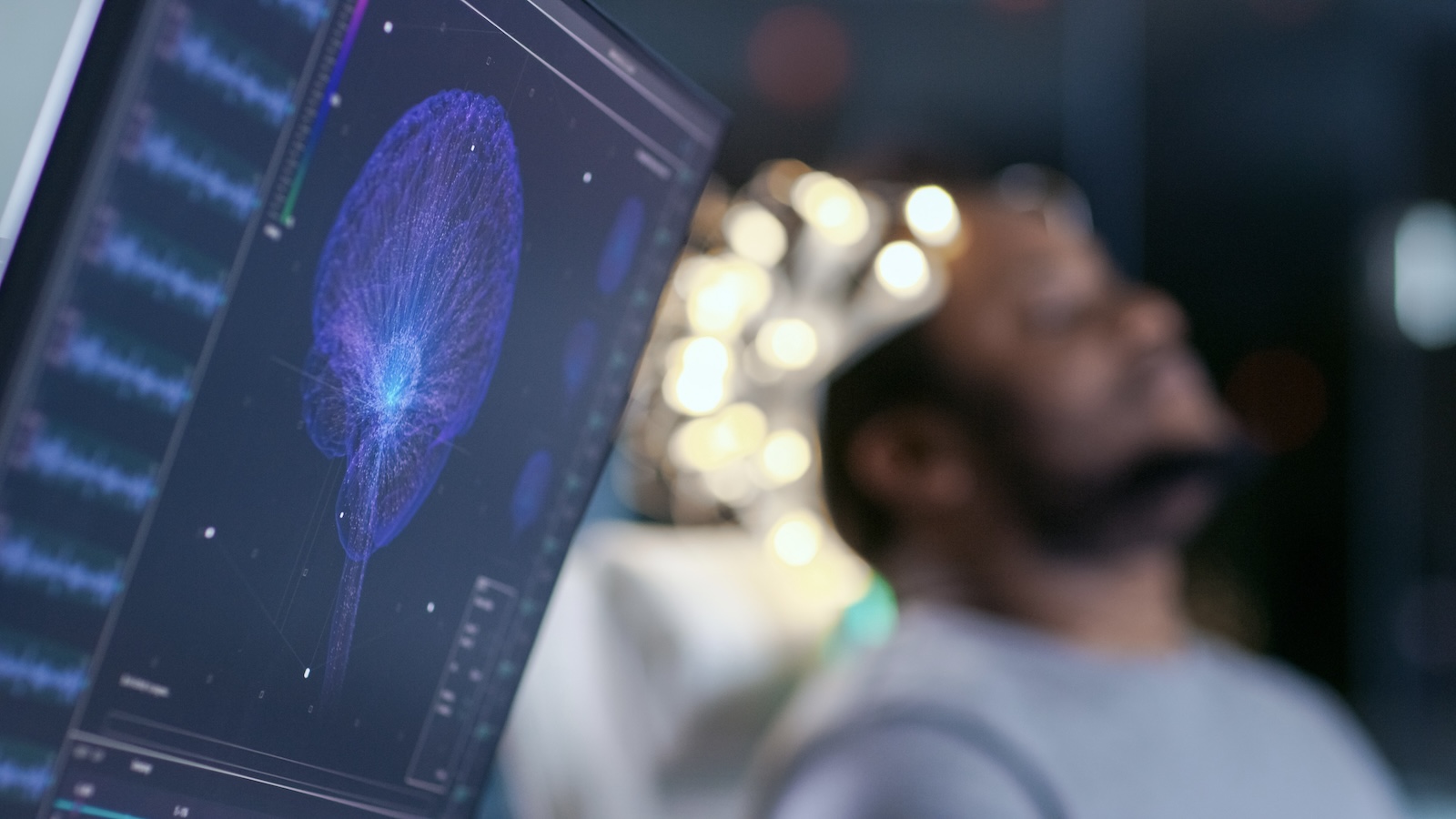 7 Things to Know About Deep Brain Stimulation Surgery