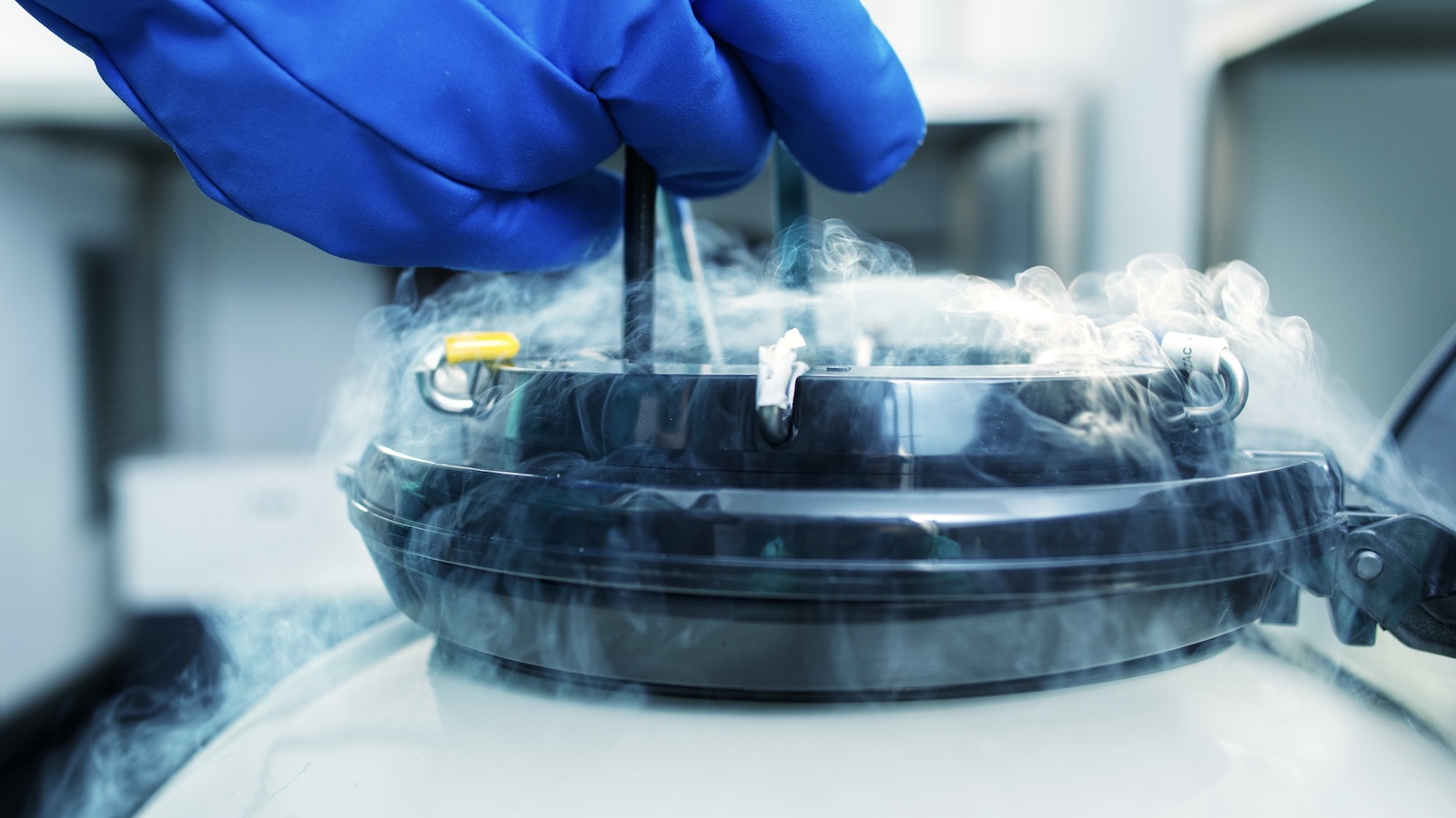 Should I Freeze My Eggs? 7 Things to Know Before You Decide