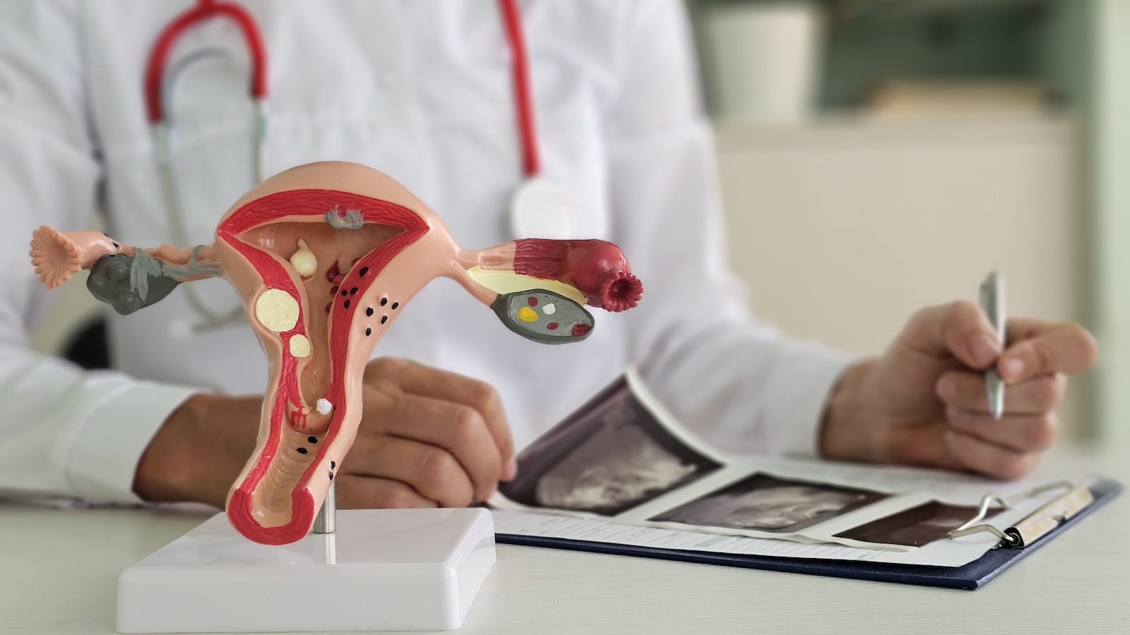 6 Endometriosis Symptoms That Aren’t Just Period Cramps