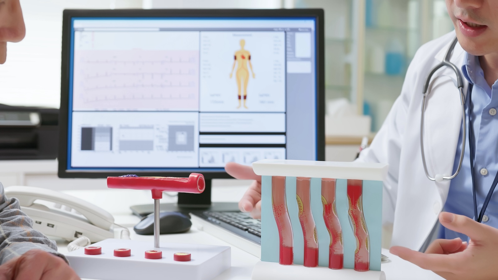 High Cholesterol? 7 Things That Determine Whether You Need a Statin
