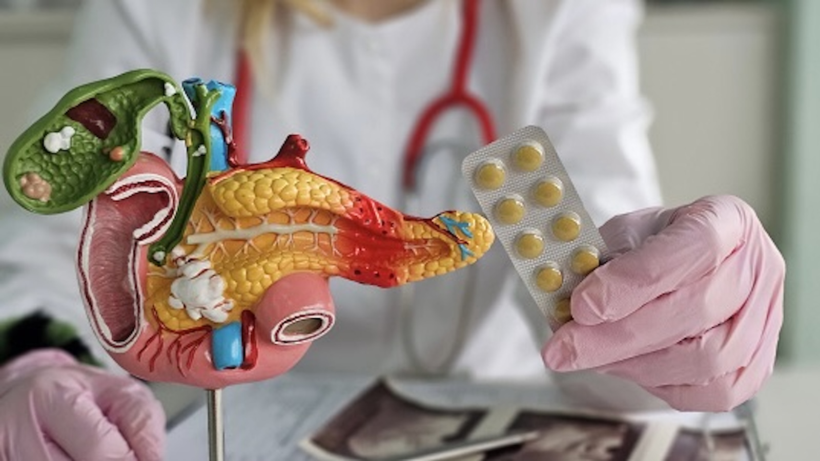 A New Pancreatic Cancer Drug Nearly Doubles Survival Rates. A Doctor Explains What It Means